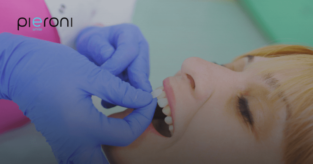 news faccette - Studio dentistico Pieroni